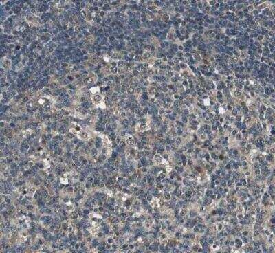 Immunohistochemistry-Paraffin: Proteasome subunit beta type 4 Antibody [NBP1-89681] - Staining of human lymph node shows moderate cytoplasmic positivity in germinal center cells.