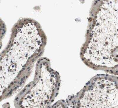 Immunohistochemistry-Paraffin: Proteasome subunit beta type 4 Antibody [NBP1-89681] - Staining of human placenta shows moderate cytoplasmic positivity in trophoblastic cells.