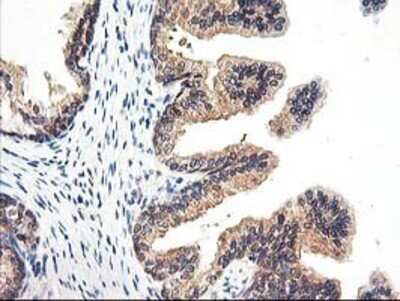 Immunohistochemistry: Proteasome subunit beta type 4 Antibody (OTI2C9) - Azide and BSA Free [NBP2-73655] - Staining of paraffin-embedded Human prostate tissue using anti-Proteasome subunit beta type 4 mouse monoclonal antibody.
