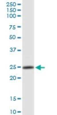 Western Blot: Proteasome subunit beta type 4 Antibody [H00005692-D01P] - Analysis of PSMB4 expression in Jurkat.