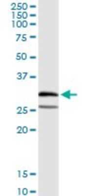 Western Blot: Proteasome subunit beta type 4 Antibody [H00005692-D01P] - Analysis of PSMB4 expression in human placenta.