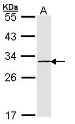 Western Blot: Proteasome subunit beta type 4 Antibody [NBP1-32009] - Sample (30 ug of whole cell lysate) A: A431 12% SDS PAGE; antibody diluted at 1:1000.