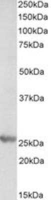 Western Blot: Proteasome subunit beta type 4 Antibody [NBP1-52080] - (0.3ug/ml) staining of Mouse Liver lysate (35ug protein in RIPA buffer). Primary incubation was 1 hour. Detected by chemiluminescence.