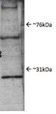 Western Blot: Proteasome subunit beta type 4 Antibody [NBP1-54592] - WB analysis of Proteasome subunit beta type 4 in rat whole brain extract. Image courtesy of anonymous customer product review.