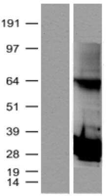 Western Blot: Proteasome subunit beta type 4 Overexpression Lysate [NBL1-14879] - Left: control (empty vector transfected control cell lysate); right: NBL1-14879 .  Antibody: DDK antibody.