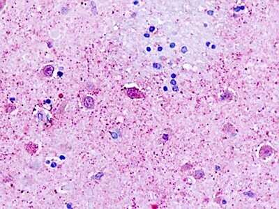 Immunohistochemistry-Paraffin: Protein A Antibody [NLS1697] - Analysis of human, brain, neurons.