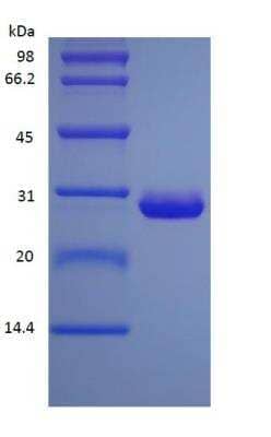 SDS-Page: Protein G His (C-Term) Protein [NBP2-35035]