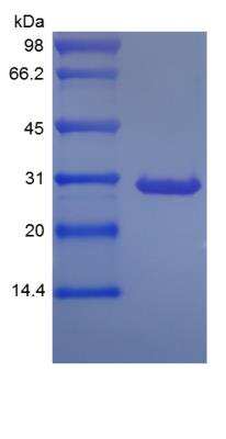 SDS-Page: Protein G His (C-Term) Protein [NBP2-35035]