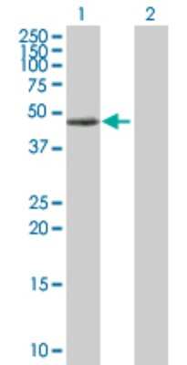 Western Blot: Protein Kinase A regulatory subunit I alpha Antibody [H00005573-D01P] - Analysis of PRKAR1A expression in transfected 293T cell line by PRKAR1A polyclonal antibody.Lane 1: PRKAR1A transfected lysate(43.00 KDa).Lane 2: Non-transfected lysate.