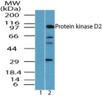 Western Blot: Protein Kinase D2 Antibody [NBP2-24592] - Western blot analysis of PKD2 in 293 cell lysate. Lane 1 shows pre-immune sera. Lane 2 shows NBP2-24592 tested at 2 ug/ml.