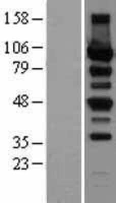 Western Blot: Protein Kinase D2 Overexpression Lysate (Adult Normal) [NBP2-08483] Left-Empty vector transfected control cell lysate (HEK293 cell lysate); Right -Over-expression Lysate for Protein Kinase D2.