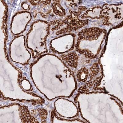 Immunohistochemistry: Protein O-Glucosyltransferase 1/POGLUT1/KTELC1 Antibody [NBP2-68633] - Immunohistochemical staining of human thyroid gland shows strong cytoplasmic positivity in glandular cells.