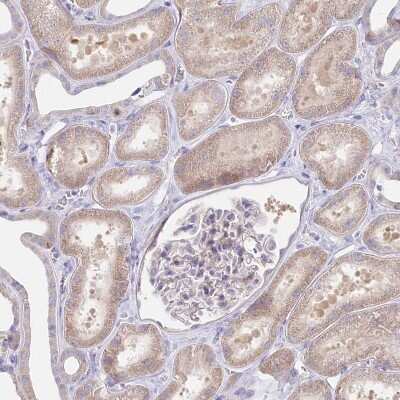 Immunohistochemistry-Paraffin Protein O-Glucosyltransferase 1/POGLUT1/KTELC1 Antibody