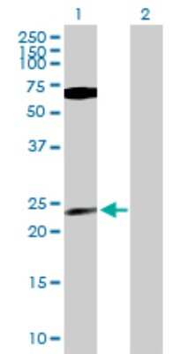 Western Blot: Protein Phosphatase 1 beta Antibody [H00005500-B01P] - Analysis of PPP1CB expression in transfected 293T cell line by PPP1CB polyclonal antibody.  Lane 1: PPP1CB transfected lysate(35.97 KDa). Lane 2: Non-transfected lysate.