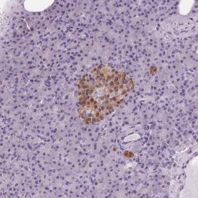 Immunohistochemistry-Paraffin: Protein Phosphatase inhibitor 1 Antibody [NBP2-37895] - Staining of human kidney shows moderate cytoplasmic positivity in renal tubules.