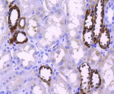 Immunohistochemistry-Paraffin: Protein Phosphatase inhibitor 1 Antibody (SN0756) [NBP2-67695] - Analysis of paraffin-embedded human kidney tissue using anti-PPP1R1A antibody. Counter stained with hematoxylin.