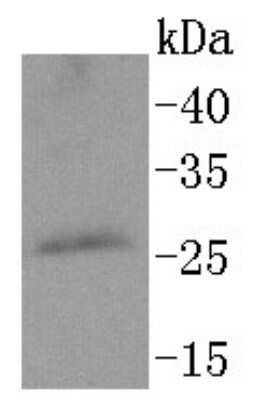 Western Blot: Protein Phosphatase inhibitor 1 Antibody (SN0756) [NBP2-67695] - Analysis of PPP1R1A on Rat brain lysates using anti-PPP1R1A antibody at 1/1,000 dilution.