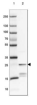 Western Blot: Protein Phosphatase inhibitor 1 Antibody [NBP2-37895] - Lane 1: Marker [kDa] 250, 130, 100, 70, 55, 35, 25, 15, 10Lane 2: Human Skeletal muscle tissue