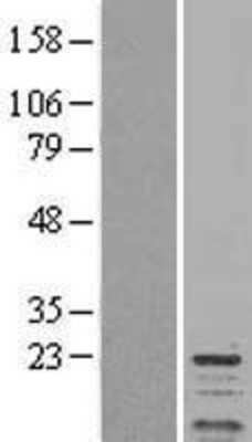 Western Blot: Protein Phosphotase inhibitor 1 Overexpression Lysate (Adult Normal) [NBL1-14678] Left-Empty vector transfected control cell lysate (HEK293 cell lysate); Right -Over-expression Lysate for Protein Phosphotase inhibitor 1.