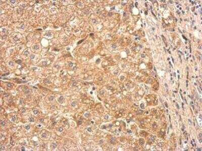 Immunohistochemistry-Paraffin: Protein S/PROS1 Antibody [NBP1-31375] - Analysis of a formalin fixed human hepatoma tissue section using PROS1antibody at 1:200 dilution.