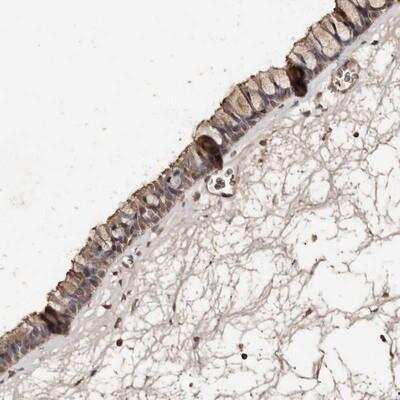Immunohistochemistry: Protein kinase-like protein SgK493 Antibody [NBP1-80758] - Staining of human nasopharynx shows moderate membranous positivity in ciliated cells.