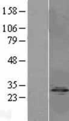 Western Blot: Protein phosphatase 1 inhibitor subunit 2 Overexpression Lysate (Adult Normal) [NBL1-14682] Left-Empty vector transfected control cell lysate (HEK293 cell lysate); Right -Over-expression Lysate for Protein phosphatase 1 inhibitor subunit 2.