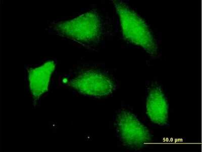 Immunocytochemistry/Immunofluorescence: Protein phosphatase 1F Antibody [H00009647-B01P] - Analysis of purified antibody to PPM1F on HeLa cell. (antibody concentration 10 ug/ml)