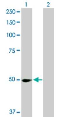 Western Blot: Protein phosphatase 1F Antibody [H00009647-D01P] - Analysis of PPM1F expression in transfected 293T cell line by PPM1F polyclonal antibody.Lane 1: PPM1F transfected lysate(49.80 KDa).Lane 2: Non-transfected lysate.