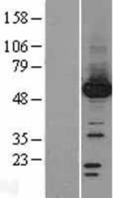 Western Blot Protein phosphatase 1F Overexpression Lysate