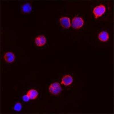 Immunocytochemistry/Immunofluorescence: Proteinase 3/Myeloblastin/PRTN3 Antibody [NBP1-25966] - Human PBMC were isolated and adjusted to 106 cells. Cells were fixed with 2% formaldehyde for 10 min at 37C. Washed twice with PBS before cytospin the cells onto microscope slides. Cells were blocked with PBS containing 1%BSA for 20 min at RT. Excess of blocking solution was removed and cells were then incubated with Rabbit Ab to c-terminal region of Pr3 (Wegener autoantigen): whole serum for 30 min at RT (diluted 1:100 in the blocking buffer). Washed 3X with PBS and incubated with anti-Rabbit Alexa 586 for further 30 min. Washed as before and nuclear counterstained with DAPI. Neutrophils and Monocytes, known to have PR3 are intensely stained by the Rabbit Ab to c-terminal region of Pr3 (Wegener autoantigen): whole serum.