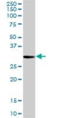 Western Blot: Proteinase 3/Myeloblastin/PRTN3 Antibody [H00005657-D01P] - Analysis of PRTN3 expression in mouse brain.