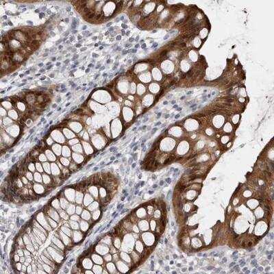 Immunohistochemistry-Paraffin: Lubricin/PRG4 Antibody [NBP1-89984] - Staining of human rectum shows strong cytoplasmic and nuclear positivity in glandular cells.