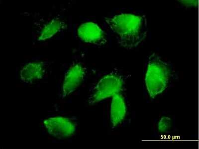 Immunocytochemistry/Immunofluorescence: Prothrombin Antibody [H00002147-B01P] - Analysis of purified antibody to F2 on HepG2 cell. (antibody concentration 10 ug/ml)