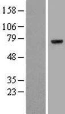 Western Blot Prothrombin Overexpression Lysate