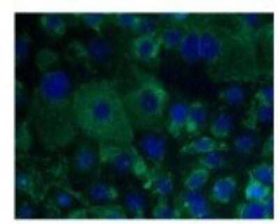 Immunocytochemistry/Immunofluorescence: Protocadherin-1 Antibody [NBP1-59209] -  Bronchial epithelial cell line (16HBE).