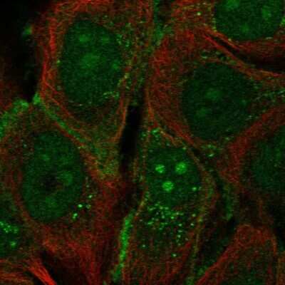 Immunocytochemistry/Immunofluorescence: Protocadherin-1 Antibody [NBP2-47321] - Staining of human cell line HaCaT shows localization to nucleoli, cell junctions & vesicles. Antibody staining is shown in green.
