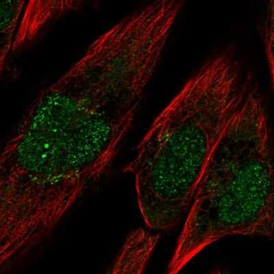 Immunocytochemistry/Immunofluorescence: Protocadherin-10 Antibody [NBP2-57934] - Staining of human cell line U-251 MG shows localization to nucleoplasm & the Golgi apparatus. Antibody staining is shown in green.