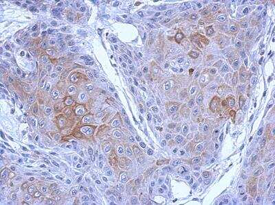 Immunohistochemistry-Paraffin: Protocadherin-10 Antibody [NBP2-19719] -  Cal27 xenograft, using PCDH10 antibody at 1:500 dilution. Antigen Retrieval: Trilogy™ (EDTA based, pH 8.0) buffer, 15min. 