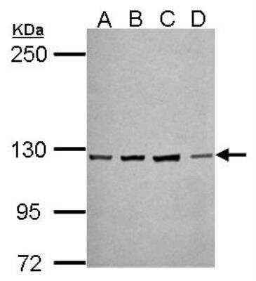 Western Blot: Protocadherin-10 Antibody [NBP2-19719] - Sample (30 ug of whole cell lysate)  A: NT2D1 B: PC-3 C: U87-MG D: SK-N-SH 5% SDS PAGE diluted at 1:50