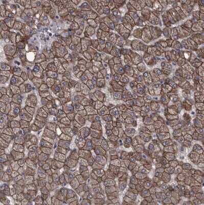 Immunohistochemistry-Paraffin Protocadherin-17 Antibody