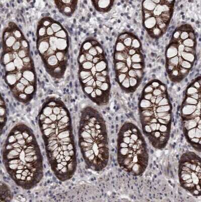 Immunohistochemistry-Paraffin: Protocadherin-17 Antibody [NBP1-80943] - Staining of human rectum shows strong membranous positivity in glandular cells.