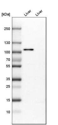 Western Blot: Protocadherin-18 Antibody [NBP1-81400] - Western blot analysis in mouse liver tissue and rat liver tissue.