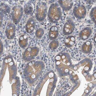 Immunohistochemistry-Paraffin: Protocadherin-8 Antibody [NBP1-88850] - Staining of human duodenum shows moderate cytoplasmic positivity in glandular cells.