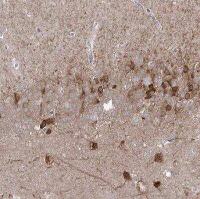 Immunohistochemistry-Paraffin: Protocadherin alpha 1 Antibody [NBP1-86297] - Staining of human hippocampus shows strong cytoplasmic positivity in a subset of neurons.