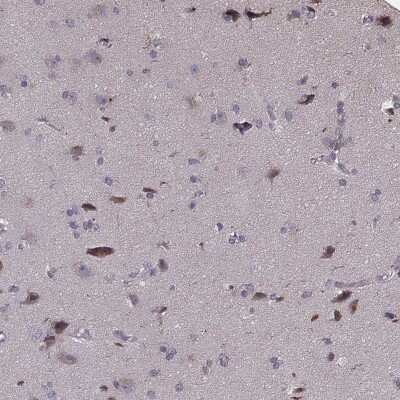 Immunohistochemistry-Paraffin: Protocadherin alpha 4 Antibody [NBP2-57952] - Staining of human cerebral cortex shows moderate cytoplasmic positivity in neuronal cells.