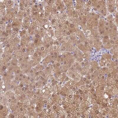 Immunohistochemistry-Paraffin: Protocadherin beta 3 Antibody [NBP2-33595] - Staining of human liver shows moderate cytoplasmic and nuclear positivity in hepatocytes.