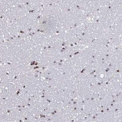 Immunohistochemistry-Paraffin: Protocadherin beta 8 Antibody [NBP2-31694] - Staining of human hippocampus shows strong nuclear positivity in glial cells.