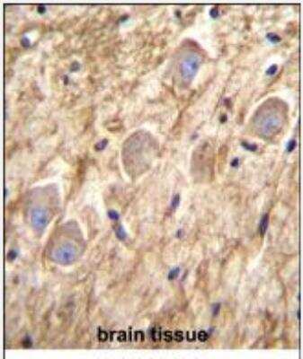 Immunohistochemistry-Paraffin: Protocadherin gamma A8 Antibody [NBP2-30028] - PCDHGA8 Antibody (C-term) (NBP2-30028)immunohistochemistry analysis in formalin fixed and paraffin embedded human brain tissue followed by peroxidase conjugation of the secondary antibody and DAB staining.This data demonstrates the use of PCDHGA8 Antibody (C-term) for immunohistochemistry. Clinical relevance has not been evaluated.