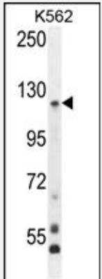 Western Blot: Protocadherin gamma A8 Antibody [NBP2-30028] - PCDHGA8 Antibody (C-term) (NBP2-30028) western blot analysis in K562 cell line lysates (35ug/lane).This demonstrates the PCDHGA8 antibody detected the PCDHGA8 protein (arrow).