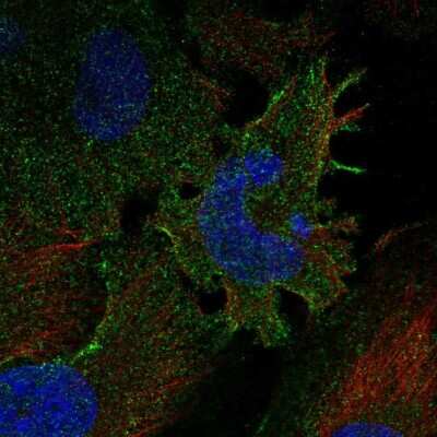 Immunocytochemistry/Immunofluorescence: Protocadherin gamma C3 Antibody [NBP2-57770] - Staining of human cell line U-251 MG shows localization to plasma membrane.